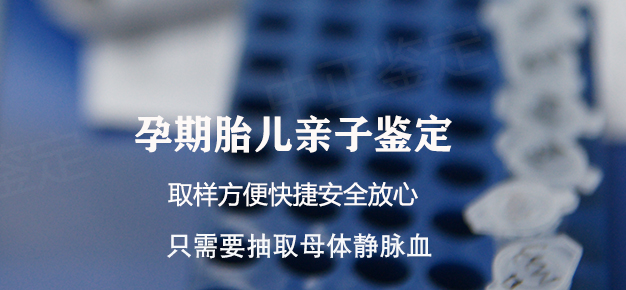 海南省孕期亲子鉴定收费明细,海南省产前亲子鉴定如何做 海南省孕期亲子鉴定收费明细,海南省产前亲子鉴定如何做